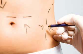 Guilherme Berto Roca - Foto 1